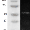 TNF-RI, Human, mAb H398-0