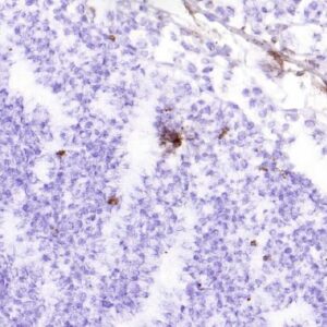 IHC-F: Frozen sections of tonsil tissue.