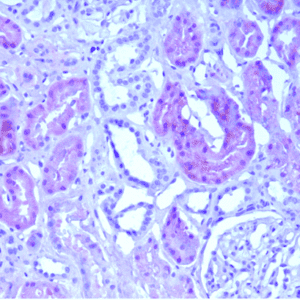 L-FABP IHC on human kidney paraffin sections