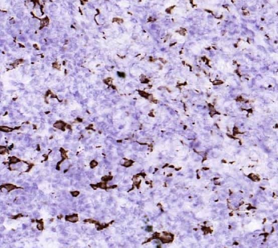 IHC-F: staining of interfollicular tissue in frozen tonsil sections.