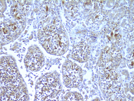 NOD2 on human jejunum. Staining of paraffin tissue section with antibody 2.017 with a dilution of 100x