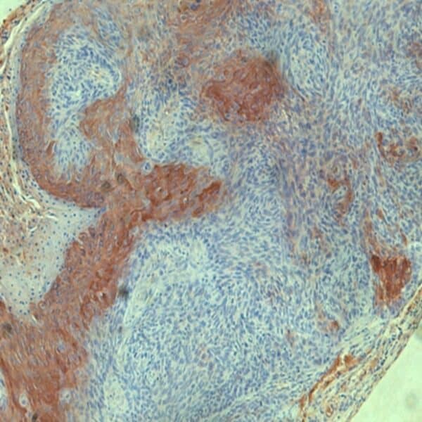 IHC-P: staining of A431 tumor sections.