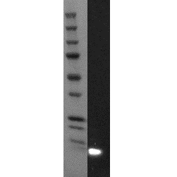 0.25 µg recombinant S100A12 was loaded. The concentration of HM2369 was 2 µg/ml.