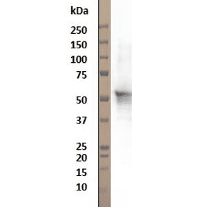 W: reduced western blot with monomeric alpha-1-antitrypsin.