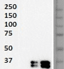 W: western blot with HM2376