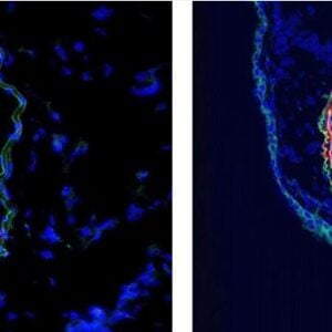 Frozen section of mouse pulmonary artery of control (left) and mouse with hypoxia-induced pulmonary hypertension. Staining of C4 (red) with HM1046 in a 1:300 dilution. Green is autofluorescence of elastic lamellae defining vascular media, Blue is cell nuc