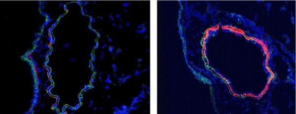 Frozen section of mouse pulmonary artery of control (left) and mouse with hypoxia-induced pulmonary hypertension. Staining of C4 (red) with HM1046 in a 1:300 dilution. Green is autofluorescence of elastic lamellae defining vascular media, Blue is cell nuc