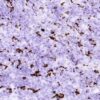 IHC-F: staining of interfollicular tissue in frozen tonsil sections.