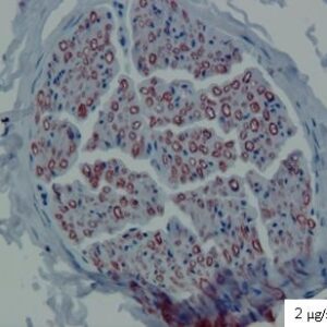 Peripheral myelin protein 22, Human, mAb CF1-1105