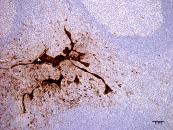 IHC: sections of human tonsil. HM2289 was used in a concentration of 2 μg/ml.