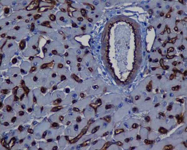 IHC-F: Frozen section of rat lung tissue of control (left) and rat with hypoxia-induced pulmonary hypertension. Staining of C4d (red) with HP8034 in a 1:200 dilution. Green is autofluorescence of elastic lamellae defining vascular media, Blue is cell nucl