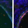 IHC-F: Frozen section of rat lung tissue of control (left) and rat with hypoxia-induced pulmonary hypertension. Staining of C4d (red) with HP8034 in a 1:200 dilution. Green is autofluorescence of elastic lamellae defining vascular media, Blue is cell nucl