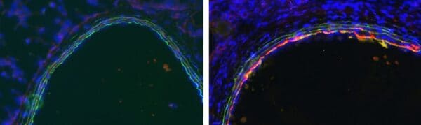 IHC-F: Frozen section of rat lung tissue of control (left) and rat with hypoxia-induced pulmonary hypertension. Staining of C4d (red) with HP8034 in a 1:200 dilution. Green is autofluorescence of elastic lamellae defining vascular media, Blue is cell nucl