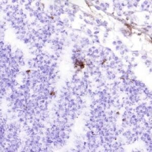 IHC-F: Frozen sections of tonsil tissue.
