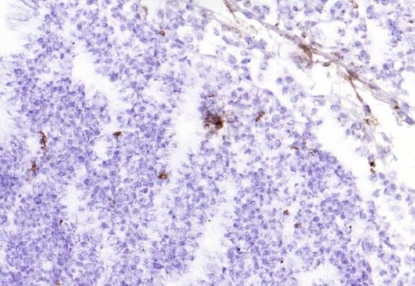 IHC-F: Frozen sections of tonsil tissue.