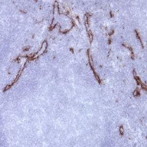 Mannose receptor, Human, mAb 15-2-1202