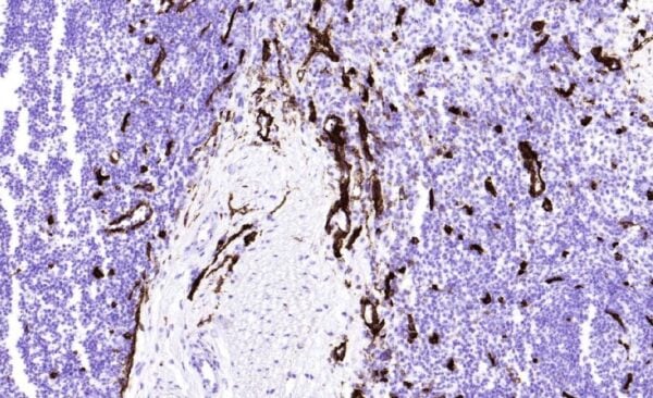 IHC-F: Frozen section of tonsil tissue. Staining especially in vascular endothelia.