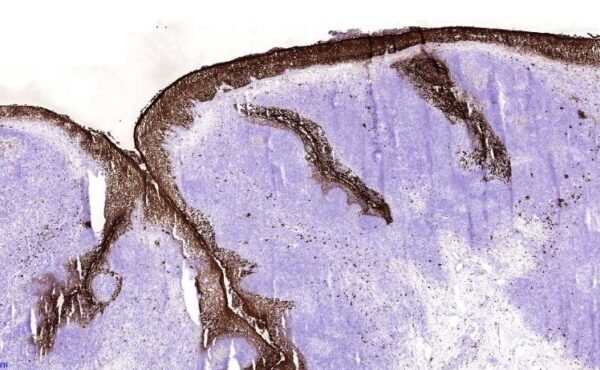 IHC-F: Staining of squamous epithelia of frozen tonsil section.