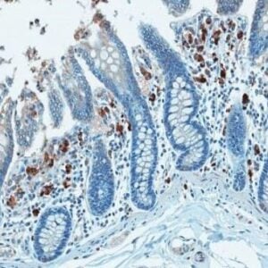 analysis of lipopolysaccharide core in paraffin-embedded rhesus macaques colon tissue using mAb WN1 222-5 (Cat.# HM6011). Images are kindly provided by Dr. Jacob D. Estes, AIDS & Cancer Virus Program, SAIC-Frederick Inc., Frederick National Laboratory for