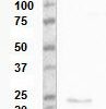W Non-reduced; Reduced and non-reduced western blot with antibody 4G4. Lane 1 for both blots is Transgelin purified protein and lane 2 pooled plasma.