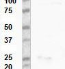 W reduced; Reduced and non-reduced western blot with antibody 4G4. Lane 1 for both blots is Transgelin purified protein and lane 2 pooled plasma.