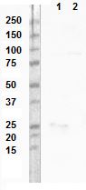 W reduced; Reduced and non-reduced western blot with antibody 4G4. Lane 1 for both blots is Transgelin purified protein and lane 2 pooled plasma.