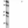 W: Non-reduced (NR) and reduced (R) western blot with antibody 15/12. Samples loaded were serum (ser): 0.2 µg/sample and purified C1-INH (C1-I), 0.3 µg/sample.