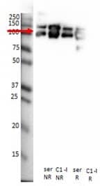 W: Non-reduced (NR) and reduced (R) western blot with antibody 15/12. Samples loaded were serum (ser): 0.2 µg/sample and purified C1-INH (C1-I), 0.3 µg/sample.