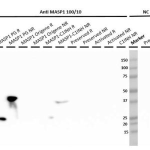 MASP-1, Human, clone 100/10-0