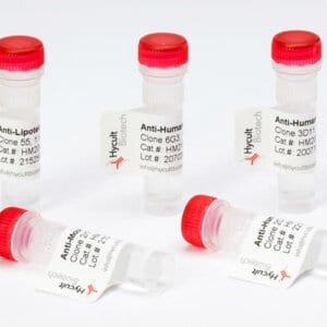 Hycult Biotech antibody in vial