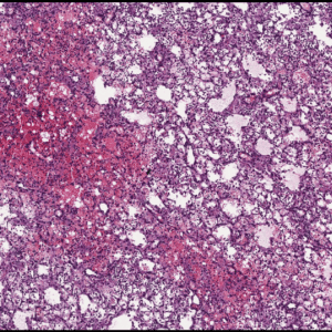 MPO Mouse Cocktail Lung IHC paraffin